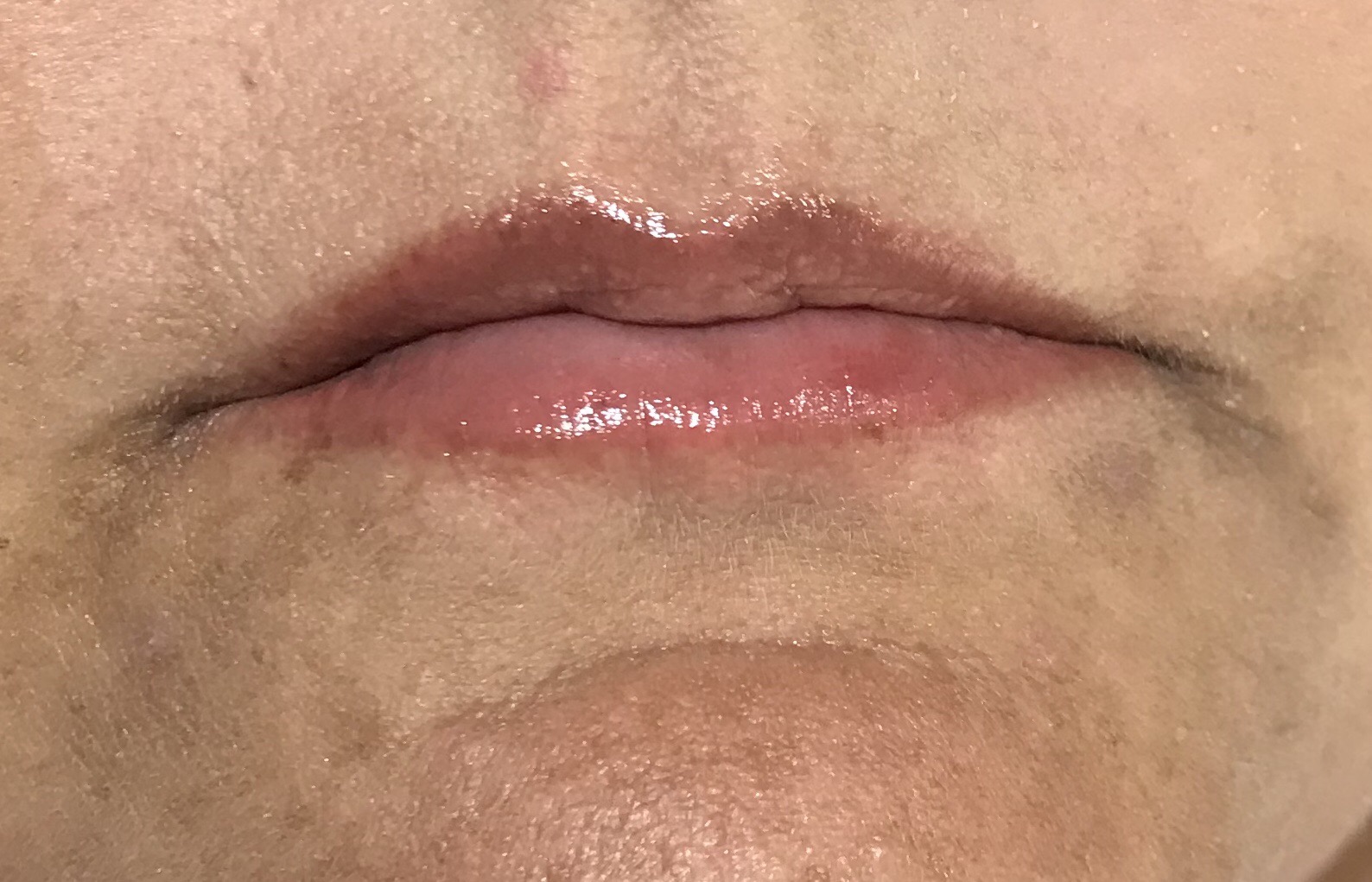 Tammy healed Permanent Lip Enhancement-2