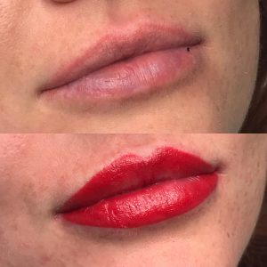Permanent makeup- tattooed lips